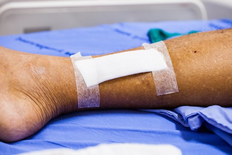 New technique heals wounds with reprogrammed skin cells