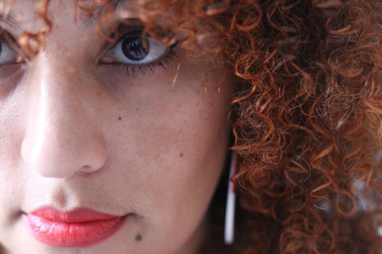 How to Treat Melasma to Get Glowing Skin